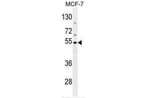 Image no. 2 for anti-Carboxylesterase 2 (CES2) (AA 343-373), (Middle Region) antibody (ABIN951482)