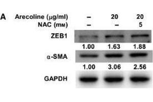 Image no. 36 for anti-Glyceraldehyde-3-Phosphate Dehydrogenase (GAPDH) (Center) antibody (ABIN2857072)