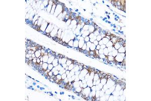 CABP1 antibody