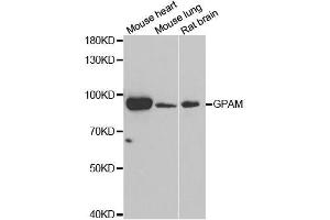 Image no. 1 for anti-Glycerol-3-Phosphate Acyltransferase, Mitochondrial (GPAM) antibody (ABIN6141299)