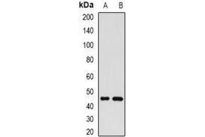 Image no. 3 for anti-Golgi Membrane Protein 1 (GOLM1) (full length) antibody (ABIN6004426)