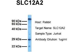 Image no. 1 for anti-Solute Carrier Family 12 (Potassium-Chloride Transporter) Member 2 (SLC12A2) (C-Term) antibody (ABIN2773831)