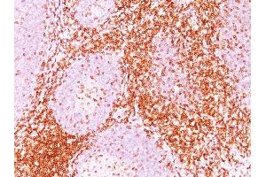 Image no. 4 for anti-CD6 (CD6) antibody (ABIN6941059)
