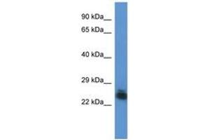 Image no. 1 for anti-Forty-Two-Three Domain Containing 1 (FYTTD1) (AA 134-183) antibody (ABIN6746830)