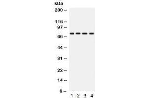 Image no. 2 for anti-Protein Kinase C, eta (PRKCH) (AA 30-389) antibody (ABIN4952175)