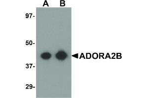 Image no. 1 for anti-Adenosine A2b Receptor (ADORA2B) (N-Term) antibody (ABIN6657277)