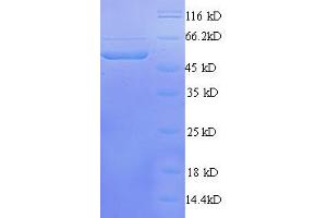 Image no. 1 for Transcriptional Adaptor 3 (TADA3) (AA 1-238), (partial) protein (GST tag) (ABIN1608084)