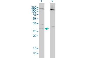 Image no. 1 for anti-B-Cell CLL/lymphoma 7B (BCL7B) (AA 124-202) antibody (ABIN564007)