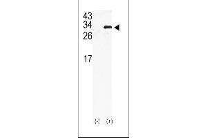 Image no. 1 for anti-Gap Junction Protein, beta 6, 30kDa (GJB6) (AA 87-117), (N-Term) antibody (ABIN5534072)