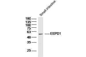 Mouse small intestine lysates probed with EEPD1 Polyclonal Antibody, Unconjugated  at 1:300 dilution and 4˚C overnight incubation.