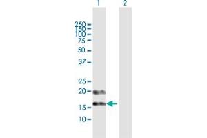 Image no. 1 for anti-Prefoldin Subunit 4 (PFDN4) (AA 1-134) antibody (ABIN948243)
