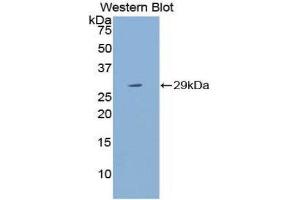 Image no. 1 for anti-Cytochrome P450, Family 21, Subfamily A, Polypeptide 2 (CYP21A2) (AA 200-414) antibody (ABIN1858587)