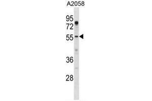 Image no. 1 for anti-Alveolar Soft Part Sarcoma Chromosome Region, Candidate 1 (ASPSCR1) (AA 64-93), (N-Term) antibody (ABIN950541)