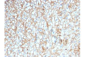 Image no. 7 for anti-CD274 (PD-L1) (AA 39-191) antibody (ABIN6939571)
