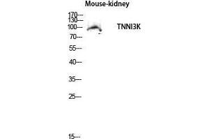 Image no. 1 for anti-TNNI3 Interacting Kinase (TNNI3K) (Internal Region) antibody (ABIN3187298)