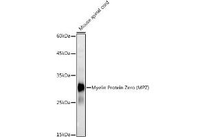 Western blot analysis of extracts of Mouse spinal cord, using Myelin Protein Zero (MPZ) antibody (ABIN3022393, ABIN3022394, ABIN1513218 and ABIN6218782) at 1:1000 dilution.