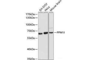 Western blot analysis of extracts of various cell lines using PPM1J Polyclonal Antibody at dilution of 1:3000.