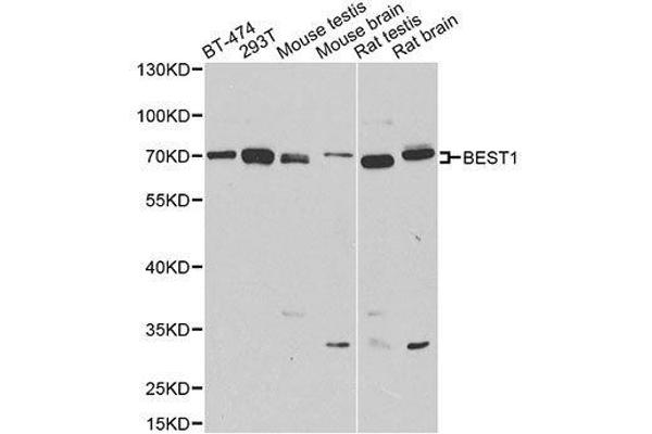 Bestrophin 1 anticorps  (AA 200-300)
