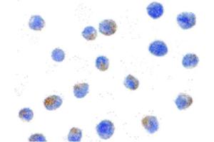 Image no. 3 for anti-conserved Helix-Loop-Helix Ubiquitous Kinase (CHUK) (C-Term) antibody (ABIN6655527)