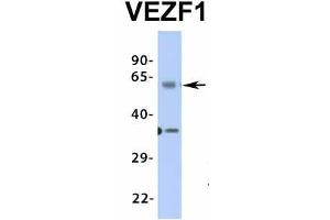 Image no. 7 for anti-Vascular Endothelial Zinc Finger 1 (VEZF1) (Middle Region) antibody (ABIN2776482)