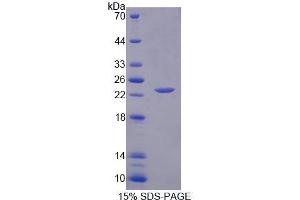 Image no. 1 for Interleukin 1 alpha (IL1A) (AA 98-271) protein (His tag) (ABIN6238523)