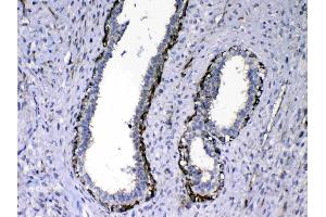 Image no. 3 for anti-Nephroblastoma Overexpressed (NOV) (AA 334-357), (C-Term) antibody (ABIN5518938)