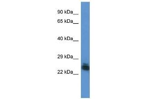 Image no. 1 for anti-Forty-Two-Three Domain Containing 1 (FYTTD1) (Middle Region) antibody (ABIN926501)