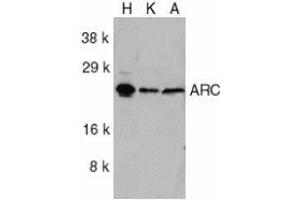 Image no. 2 for anti-Nucleolar Protein 3 (Apoptosis Repressor with CARD Domain) (NOL3) (C-Term) antibody (ABIN499327)