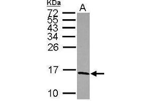 Image no. 3 for anti-NADH Dehydrogenase (Ubiquinone) Fe-S Protein 5, 15kDa (NADH-Coenzyme Q Reductase) (NDUFS5) (Center) antibody (ABIN2855190)