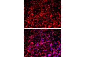 Image no. 2 for anti-Mitochondrial Import Receptor Subunit TOM20 homolog (TOMM20) antibody (ABIN6149382)