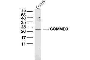 COMMD3 antibody  (AA 101-195)