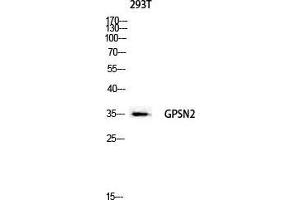Image no. 1 for anti-Trans-2,3-Enoyl-CoA Reductase (TECR) (C-Term) antibody (ABIN3184921)