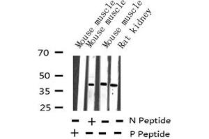Image no. 2 for anti-Jun B Proto-Oncogene (JUNB) (pSer259) antibody (ABIN6256223)