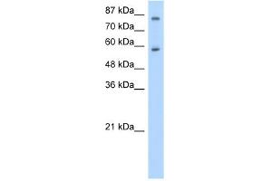 Image no. 1 for anti-Zinc Finger Protein 777 (ZNF777) (C-Term) antibody (ABIN2780980)