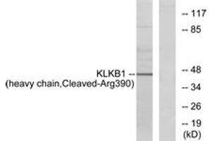 Image no. 1 for anti-Kallikrein B, Plasma (Fletcher Factor) 1 (KLKB1) (AA 341-390), (Cleaved-Arg390) antibody (ABIN1536154)