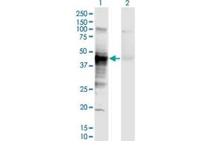 Western Blot analysis of HLA-A expression in transfected 293T cell line by HLA-A monoclonal antibody (M01), clone 2D6.