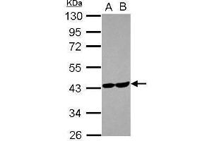 WB Image Sample (30 ug of whole cell lysate) A: U87-MG B: MCF-7 10% SDS PAGE antibody diluted at 1:1000