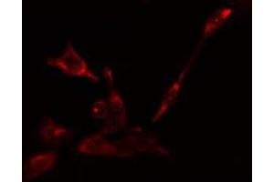 Image no. 2 for anti-Eukaryotic Translation Initiation Factor 5B (EIF5B) antibody (ABIN6257600)