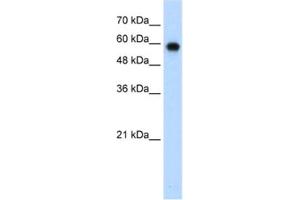 Image no. 1 for anti-SWI/SNF Related, Matrix Associated, Actin Dependent Regulator of Chromatin, Subfamily D, Member 2 (SMARCD2) antibody (ABIN2461675)