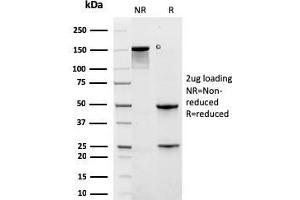 Image no. 1 for anti-Keratin 6A (KRT6A) antibody (ABIN6939868)