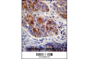 Image no. 1 for anti-HCLS1 Associated Protein X-1 (HAX1) (AA 161-190), (C-Term) antibody (ABIN656245)