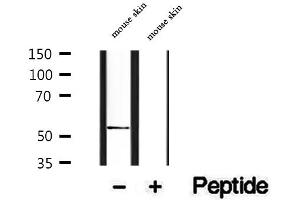 Image no. 2 for anti-Protein Disulfide Isomerase Family A, Member 6 (PDIA6) (C-Term) antibody (ABIN6264114)