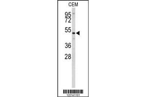Western Blotting (WB) image for anti-Carnosine Dipeptidase 1 (Metallopeptidase M20 Family) (CNDP1) antibody (ABIN2158295)