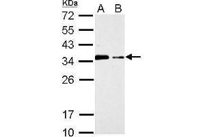 WB Image CIS antibody [C2C3], C-term detects CISH protein by Western blot analysis.