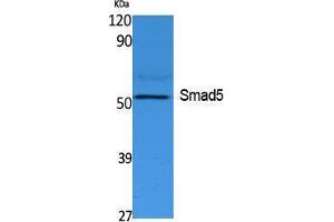 Image no. 1 for anti-SMAD, Mothers Against DPP Homolog 5 (SMAD5) (Internal Region) antibody (ABIN3187646)