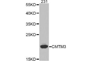 Image no. 1 for anti-CKLF-Like MARVEL Transmembrane Domain Containing 3 (CMTM3) antibody (ABIN1871923)