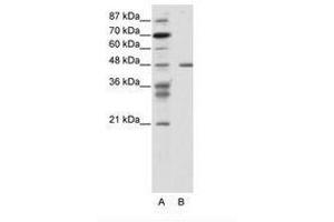 Image no. 1 for anti-Proteasome (Prosome, Macropain) 26S Subunit, ATPase, 2 (PSMC2) (N-Term) antibody (ABIN343937)