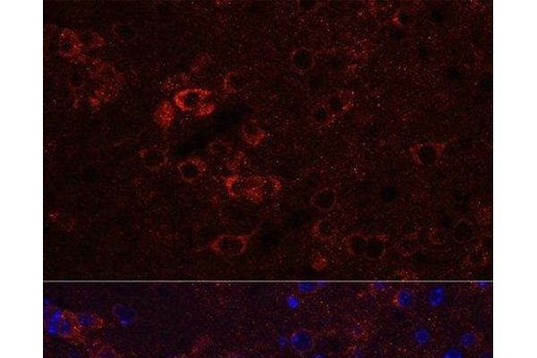 HuC/ELAVL3 antibody