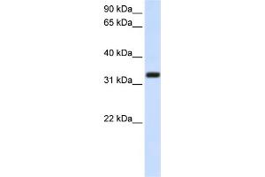 Image no. 1 for anti-Transmembrane Protein 66 (TMEM66) (Middle Region) antibody (ABIN2782871)