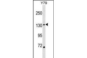 SALL1 Antibody (N-term) (ABIN1538924 and ABIN2848842) western blot analysis in Y79 cell line lysates (35 μg/lane).